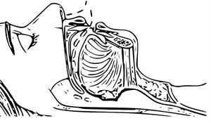 sleep-apnea-diagram