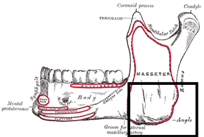 Temporomandibular Joint Disorder