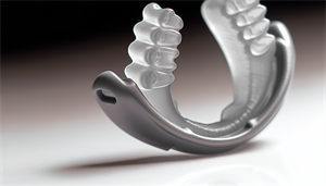 Photo of an oral appliance for sleep apnea